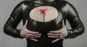 Xet 3
